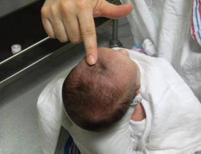 اسباب تحذير الاطباء من لمس قمة رأس طفل حديث الولادة